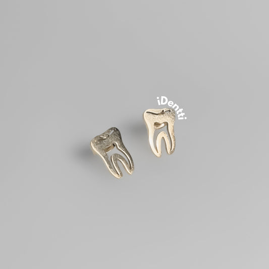Aretes muela
